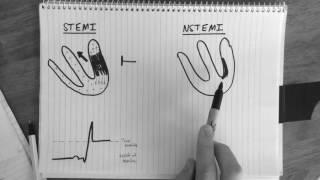 ST-segment changes in STEMI & NSTEMI explained