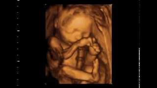 3d/4d Ultrasound AT 23 Weeks from GoldenView Ultrasound