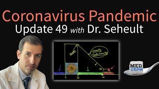 Coronavirus Pandemic Update 49: New Data on COVID-19 vs Other Viral Infections (Ventilator Outcomes)