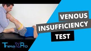 Brodie–Trendelenburg Test | Venous Insufficiency