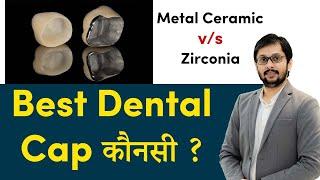 सबसे अच्छी डेंटल कैप कौनसी ? Which is the best dental cap? Best Quality dental cap in Indore!