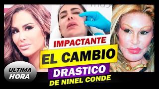 ¡NINEL CONDE IMPACTA con su NUEVO ROSTRO! ¿Cirugías Extremas o Necesidad? ¡NO CREERÁS el CAMBIO