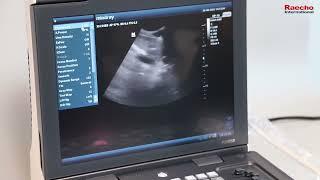 Raecho / Mindray DP-10 ultrasound machine