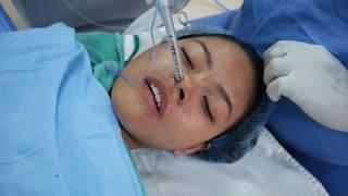 Putting a Girl into Sleep - General Anesthesia - Intubation