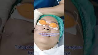 Pengalaman PICO LASER TREATMENT di Klinik Kecantikan Mandaya Royal Hospital Puri