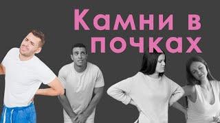 Камни в почках. Симптомы, удаление камней, пиво