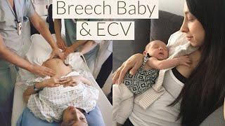 Breech Baby & Successful ECV | Tips for Success and My Experience