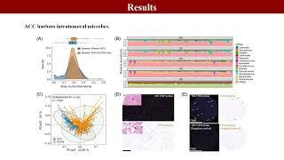 iMeta|Intratumoral microbiota is associated with prognosis in patients with adrenocortical carcinoma