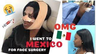 I'M BACK!! I GOT FACE SURGERY IN MEXICO + RECOVERY | JENEEVALOVE