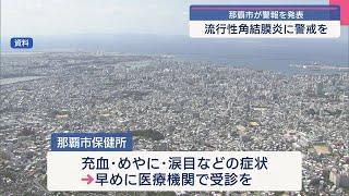 那覇市が結膜炎警報を発表