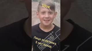 я нашел лицо лолотрека