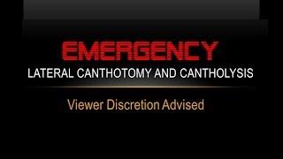 Emergency Lateral Canthotomy and Cantholysis