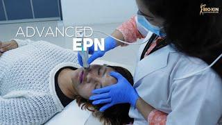 Advanced EPN Treatment পাচ্ছেন সর্বোচ্চ ৫০% পর্যন্ত ছাড়! | I Love My Skin |