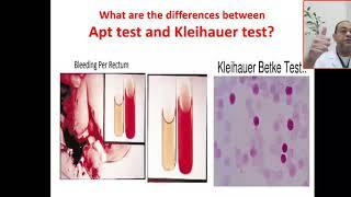 What are the differences between Apt and klehauer- Betke test ? Swallowing maternal blood, Rh  sent.