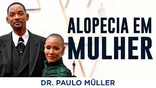 Caso da Esposa do Will Smith, Alopecia extensa em mulheres - Dr. Paulo Müller dermatologista