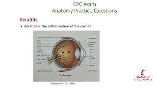 "Keratitis: Corneal Inflammation #Medical Coding Shorts #MedicalCoding #EyeHealth #Anatomy"