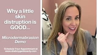 Microdermabrasion Demo, and why a little skin disruption is a GOOD THING!