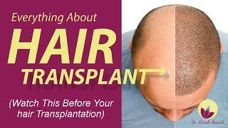  Everything About Hair Transplant Surgery In India | By Dr. Ritesh Anand