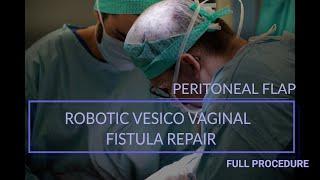 Robotic (Da Vinci) Vesicovaginal Fistula Repair / Full Procedure