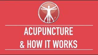 Benefits of Acupuncture - Advanced Sports & Family Chiropractic & Acupuncture