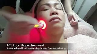 ACE Face Shaper at Elements Wellness Group