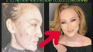 Beauty blogger uses cosmetics to make woman s acne disappear