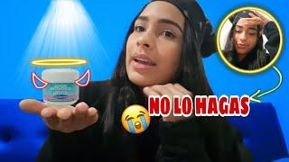 STORY TIME: MI EXPERIENCIA USANDO EL ÁCIDO RETINOICO (0.05%) PARA MI ACNÉ  | ANAFERTOR