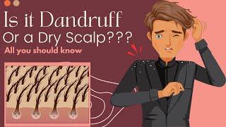 Is It Dandruff Or A Dry Scalp? Here's What You Need To Know