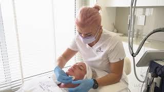 Secret RF Microneedling at Lucia Clinic Dubai