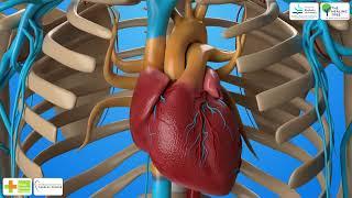 PULMONARY ARTERY BANDING - MEDICAL ANIMATION 3D