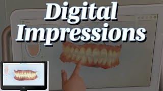 Digital Impression