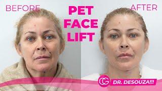 PET FACE LIFT - FULL PROCEDURE AND TESTIMONY! - CG Cosmetic surgery