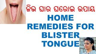 ଜିଭ ଘାର ଘରୋଇ ଉପାୟ,ODIA,ODIA HEALTH TIPS,ODIA HOME REMEDIES,CURE BLISTER TONGUE,VARKHA,SIMPLE, BEST,