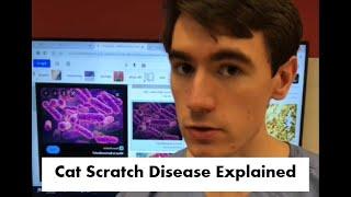 Cat Scratch Disease EXPLAINED