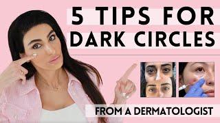 5 Tips for Dark Circles from a Dermatologist