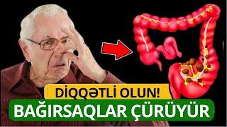 Bağırsaqların Çürüdüyü Göstərən 10 Əlamət! - İnsanların 90%i Bilmir