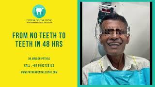 From No Teeth To Teeth In Just 48 Hours! | Pathak Dental Clinic, Pimpri Chinchwad, Pune