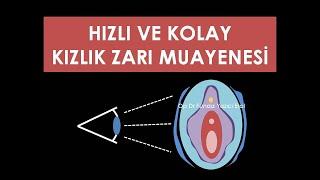 Kolay ve Hızlı Kızlık Zarı Muayenesi Antalya - Op. Dr. Funda Yazıcı Erol