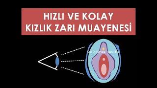 🟡 Kolay ve Hızlı Kızlık Zarı Muayenesi - Op. Dr. Funda Yazıcı Erol