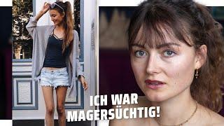 So ist es magersüchtig zu sein!