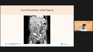 2022 KCA Virtual Patient Symposium: Diagnosis and Staging