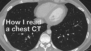 How I Read a Chest CT