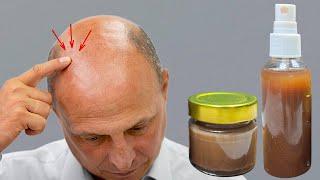 I am shocked! With the help of this ingredient, hair is growing like crazy in my bald spot!