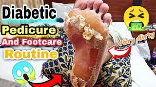 Diabetic Pedicure Tutorial and Foot Care Routine and home  Footcare33