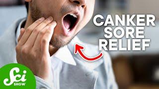How to Get Rid of Canker Sores, According to Science