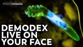 These Mites Are Probably On Your Face Right Now