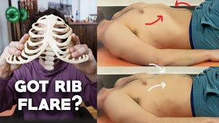 Rib Flare - Why you can't FIX it!