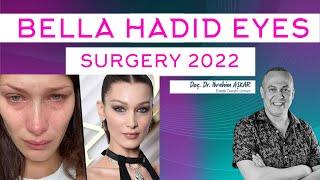 BELLA HADİD EYES SURGERY (UPDATE) 2022!!!