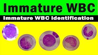 How to differentiate immature WBC | immature WBC identification | Hematology