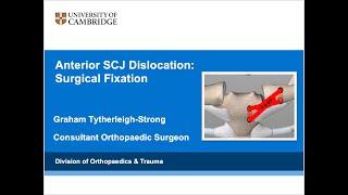 Anterior SCJ dislocation: Surgical Fixation